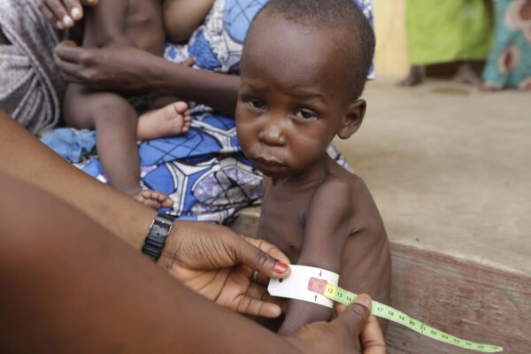 Pneumonia: Leading Child Killer in Nigeria, Whips Out over 162,000 Young Lives Yearly