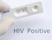 HIV, AIDS 2