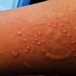 WHO officials addressing news briefing on global disease response