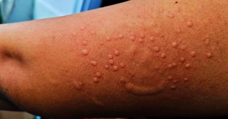 WHO officials addressing news briefing on global disease response