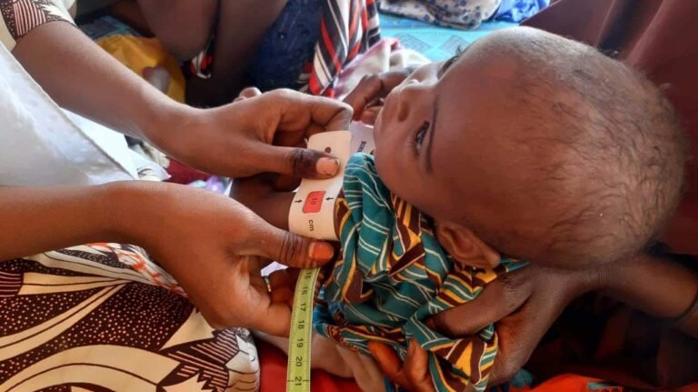 Health workers treat malnourished children in Kaduna
