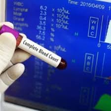 Small diagnostic laboratory along Airport Road in Lugbe, Abuja