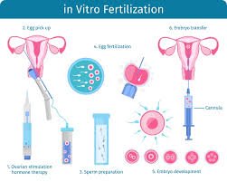 Medical illustration showing IVF fertilisation process