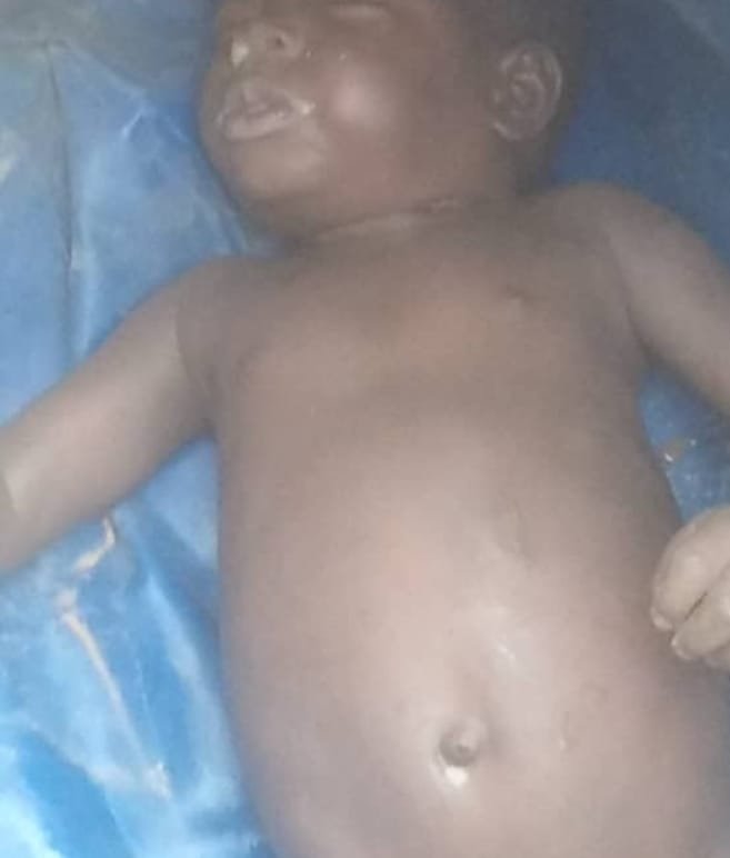 Emergency responders at a well after child accident in Kano