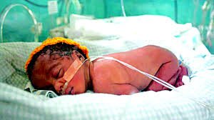 Medical staff attend to premature baby in Nigerian public hospital