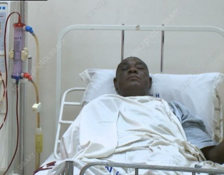 Dialysis machines deployed to Nigerian hospitals for severe Lassa fever treatment