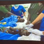 Surgical team at Modibbo Adamawa University Teaching Hospital