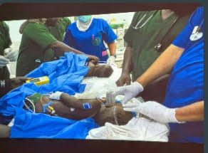 Surgical team at Modibbo Adamawa University Teaching Hospital