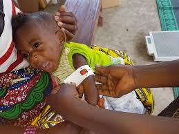 Children receiving nutritional support in a community health centre
