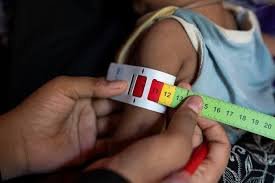Health worker measuring child’s arm for malnutrition screening