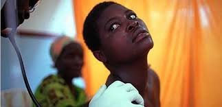 Meningitis Outbreak Claims 33 Lives in Sokoto