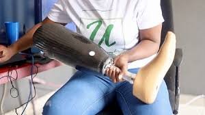 UNIDO officials hand over advanced 3D prosthetic equipment in Abuja