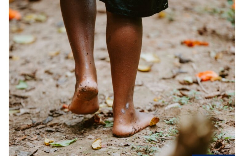 WHO Warns Rising Fungal Diseases and Drug Resistance Threaten Millions