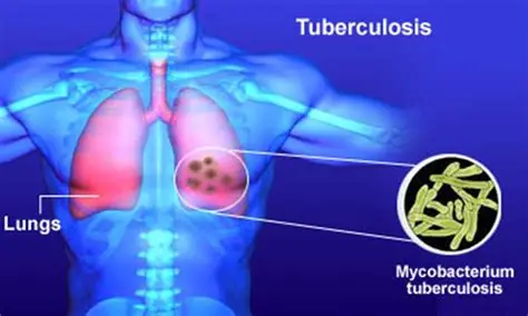 Health officials discuss Akwa Ibom's international tuberculosis award nomination.