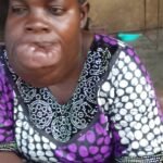 Deborah Ajibade, a Nigerian cancer patient, whose delayed cancer diagnosis and inability to afford treatment highlight the urgent need for earlier detection and accessible cancer care in Nigeria.
