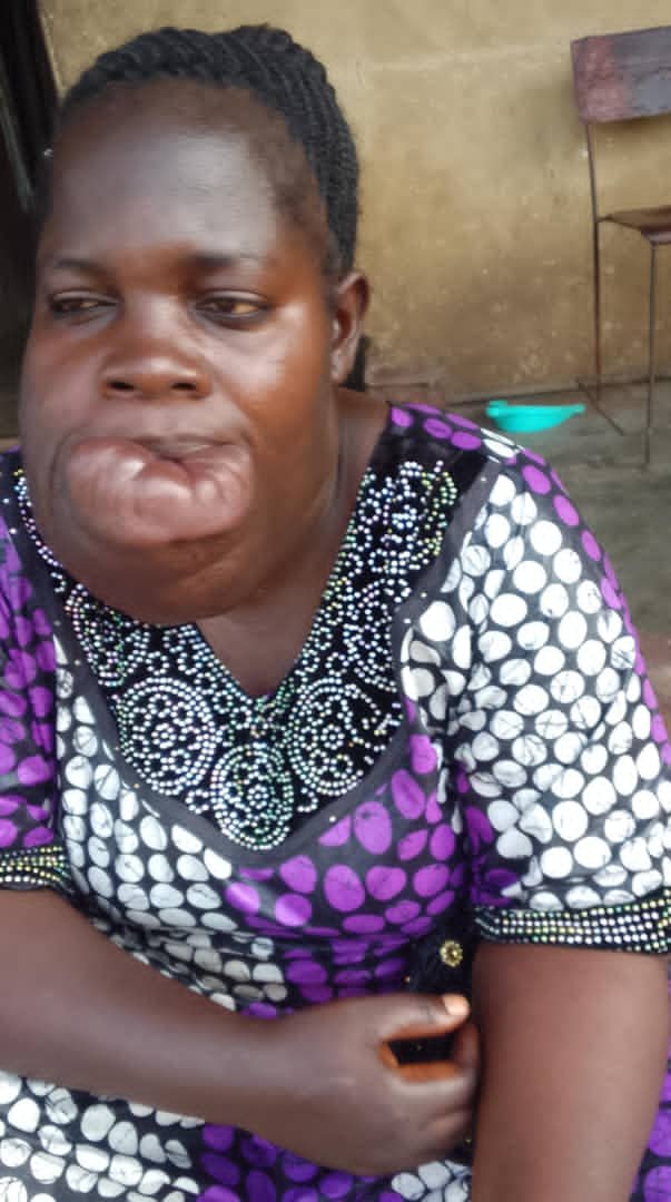 Deborah Ajibade, a Nigerian cancer patient, whose delayed cancer diagnosis and inability to afford treatment highlight the urgent need for earlier detection and accessible cancer care in Nigeria.
