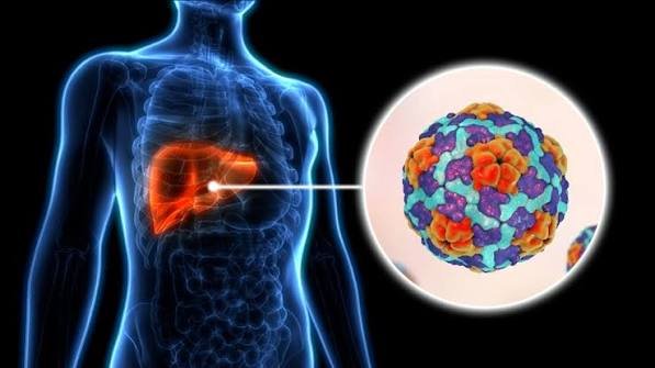 Hepatitis Diet: Nutrition Expert Debunks Food Myths