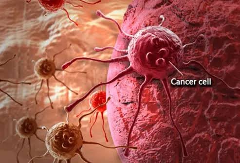 cancer cells