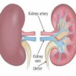 Silent Killer: Nigeria's Kidney Disease Crisis Explained