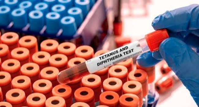 Health workers respond to the Plateau diphtheria outbreak at a treatment facility in Jos.