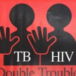 HIV and TB