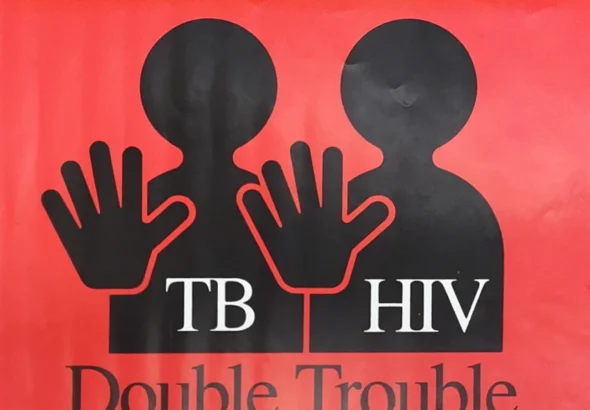 HIV and TB