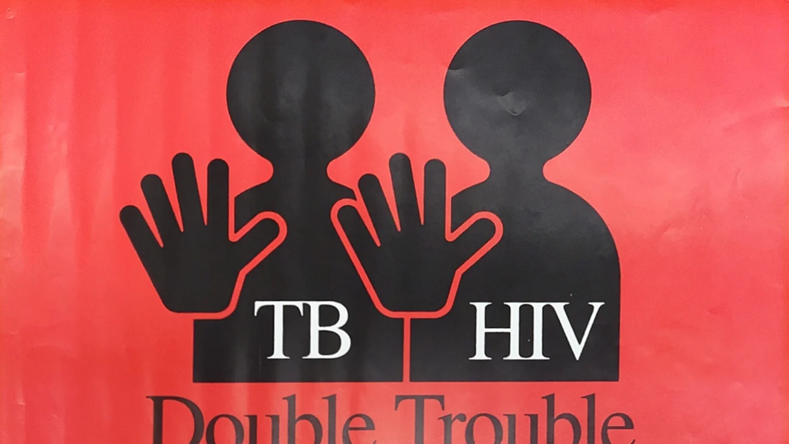 HIV and TB