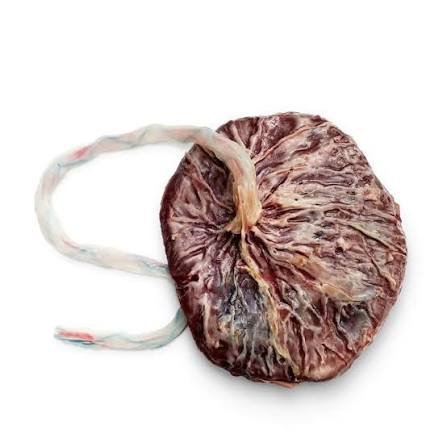 Researchers investigate placenta-derived tissue to support nerve recovery after prostate cancer surgery.